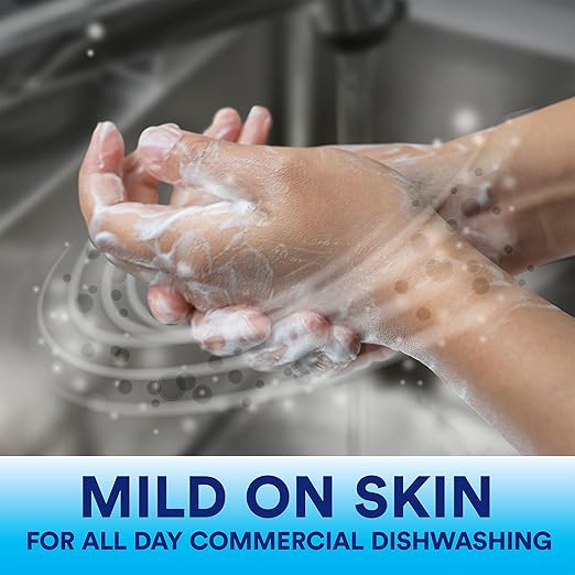 P&G Dawn Dishwashing Liquid Soap Detergent, Bulk Degreaser Removes Greasy Foods from Pots, Pans and Dishes in Commercial Restaurant Kitchens, Regular Scent, 38 oz. (Case of 8) (Packaging May Vary)